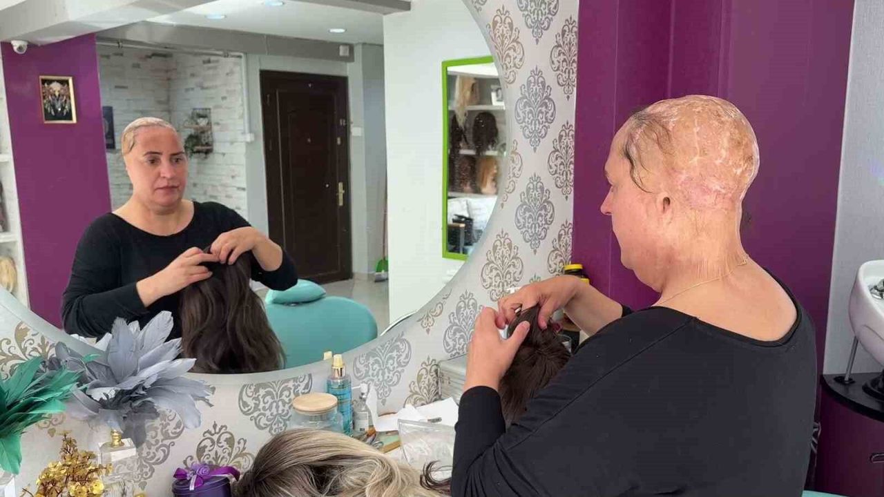 12 yaşında saçlarını ve kulaklarını kaybetti: Şimdi kadınlara umut oluyor