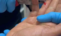 Balık macerası hastanede bitti: Parmağına saplanan olta iğnesini itfaiye çıkarttı