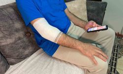 Başakşehir'de sitenin güvenlik görevlisine sahipli köpek saldırdı