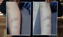 Diyarbakır'da özel okulda 8 yaşındaki çocuğun darbedildiği iddiası