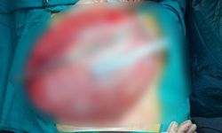 Kilo vermek için hastaneye giden çocuğun karnından 3,5 kiloluk kist çıktı