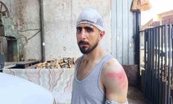 Şanlıurfa'da trafikte yavaş giden sürücüye meydan dayağı: Burnu kırıldı, başına 8 dikiş atıldı