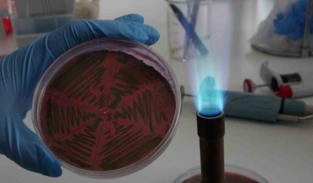 Çiğ süt, gıdayla bulaşan idrar yolu enfeksiyonlarına kapı açıyor