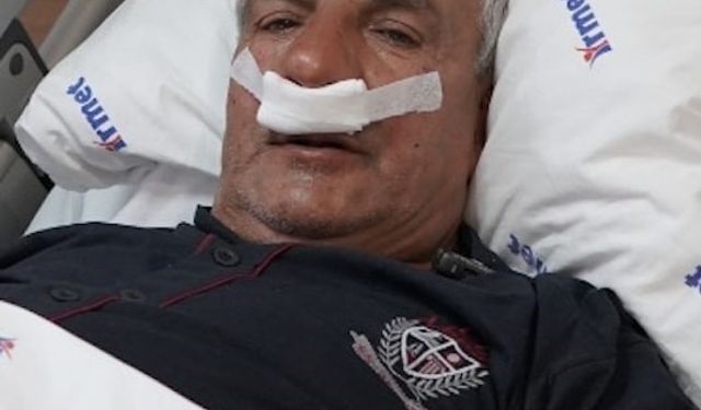 65 yaşındaki adamın burnundan 100 gramlık taş çıkarıldı