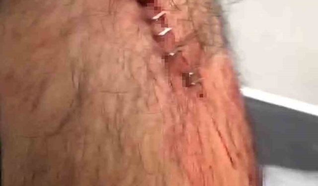 Şanlıurfa'da görev yapan öğretmene sokak ortasında jiletli saldırı