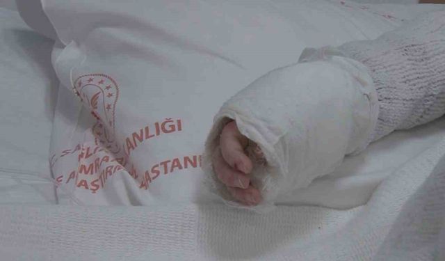 Üzerine kaynar su dökülen bebeğin vücudunun yüzde 27'si yandı