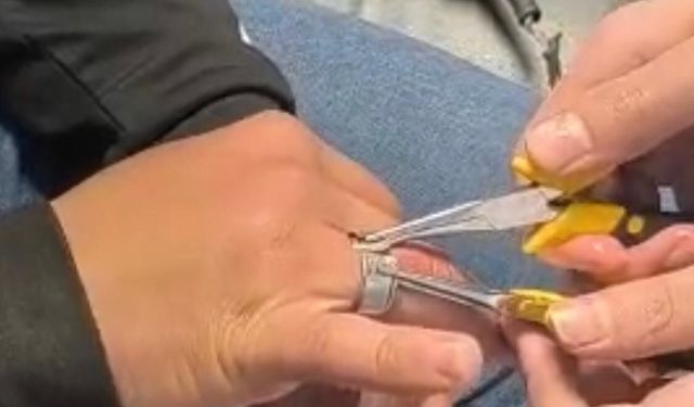 Batman'da parmağa sıkışan yüzük itfaiye ekiplerince çıkarıldı