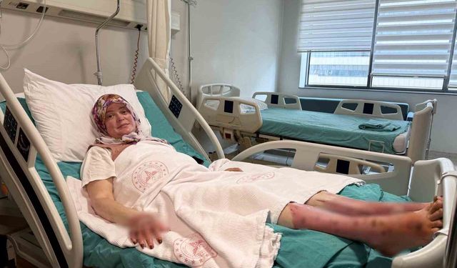 Karavandaki patlama sonrası vücudunun yüzde 70'i yandı: 'Karadeniz turu yapacaktık, alev topuna döndüm'