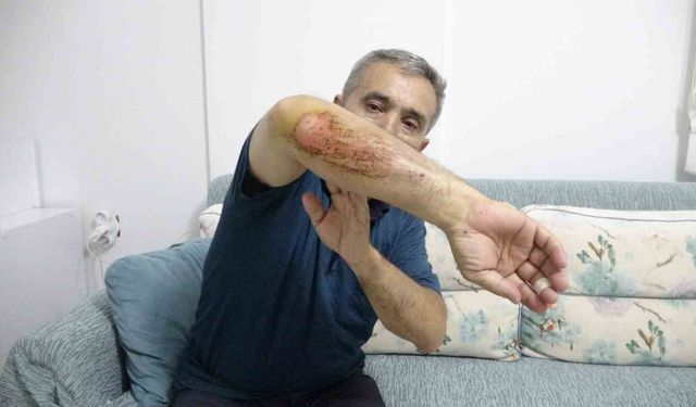 Otizmli oğluyla doğa gezisi sırasında sahipli köpeklerin saldırısına uğradı