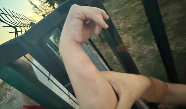 Kolu demir korkuluğa sıkışan vatandaş itfaiye ekiplerince kurtarıldı