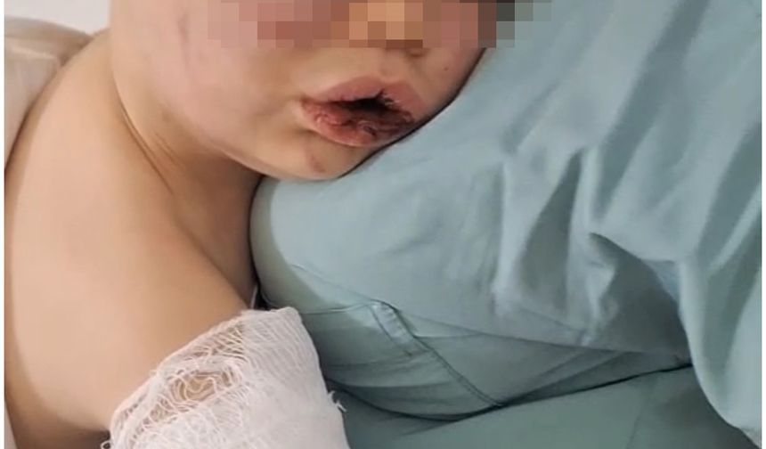 Darp sonucu hastanelik olan bebek devlet korumasına alınacak