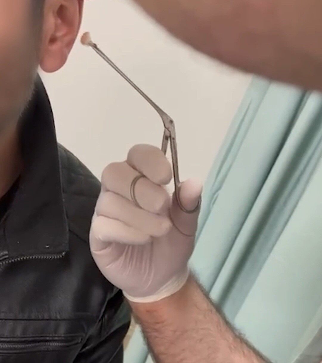 Kayseri'de kulağının içine uyuşturucu saklayan şüpheli yakalandı