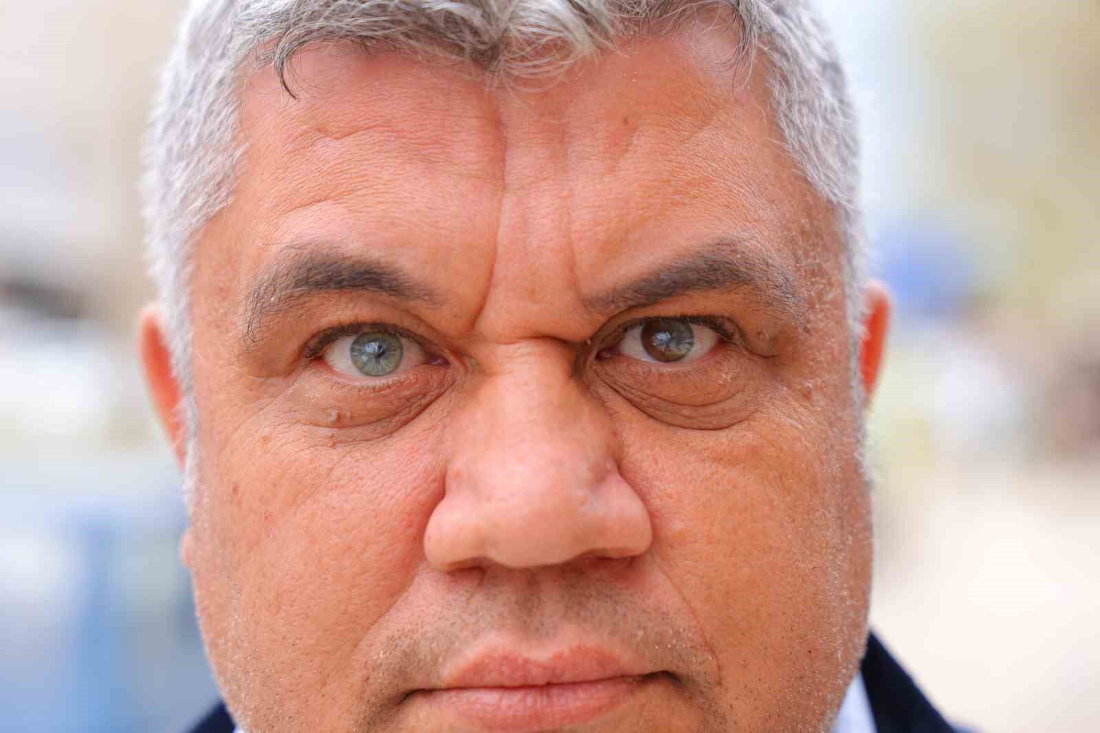 Kahramanmaraşlı adam 3 renkli gözleriyle görenlerin ilgisini çekiyor