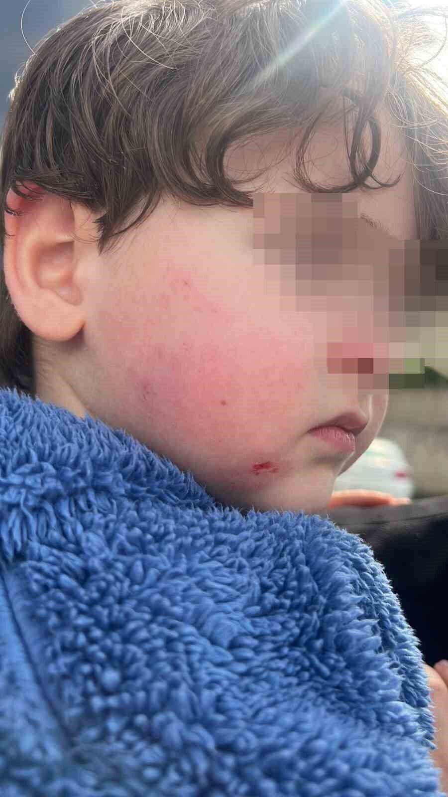 Kreşe bıraktığı çocuğunu darp edilmiş halde aldı