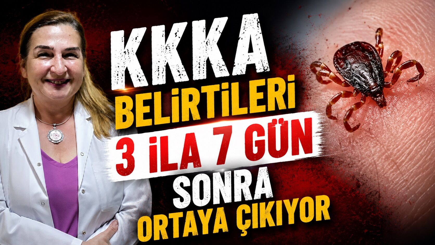 KKKA belirtileri 3 ila 7 gün sonra ortaya çıkıyor