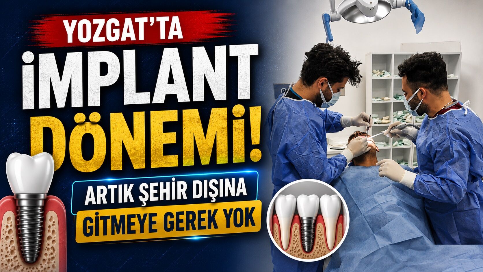 Yozgat'ta İmplant Dönemi: Artık Şehir Dışına Gitmeye Gerek Yok