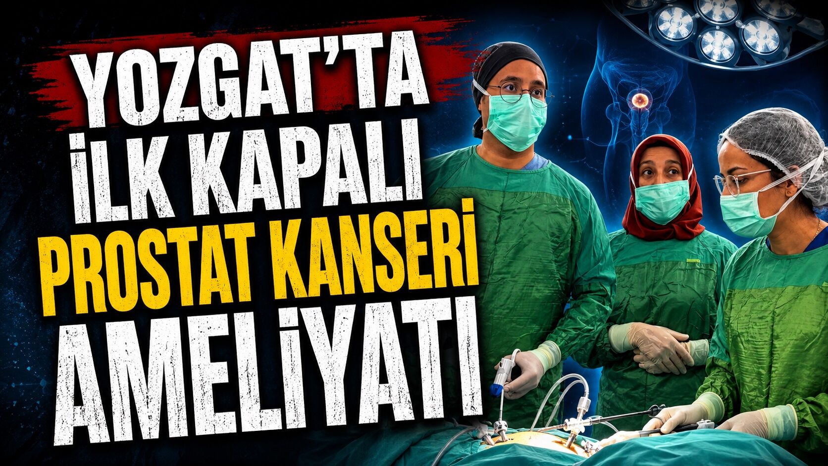 Yozgat'ta İlk Kapalı Prostat Kanseri Ameliyatı