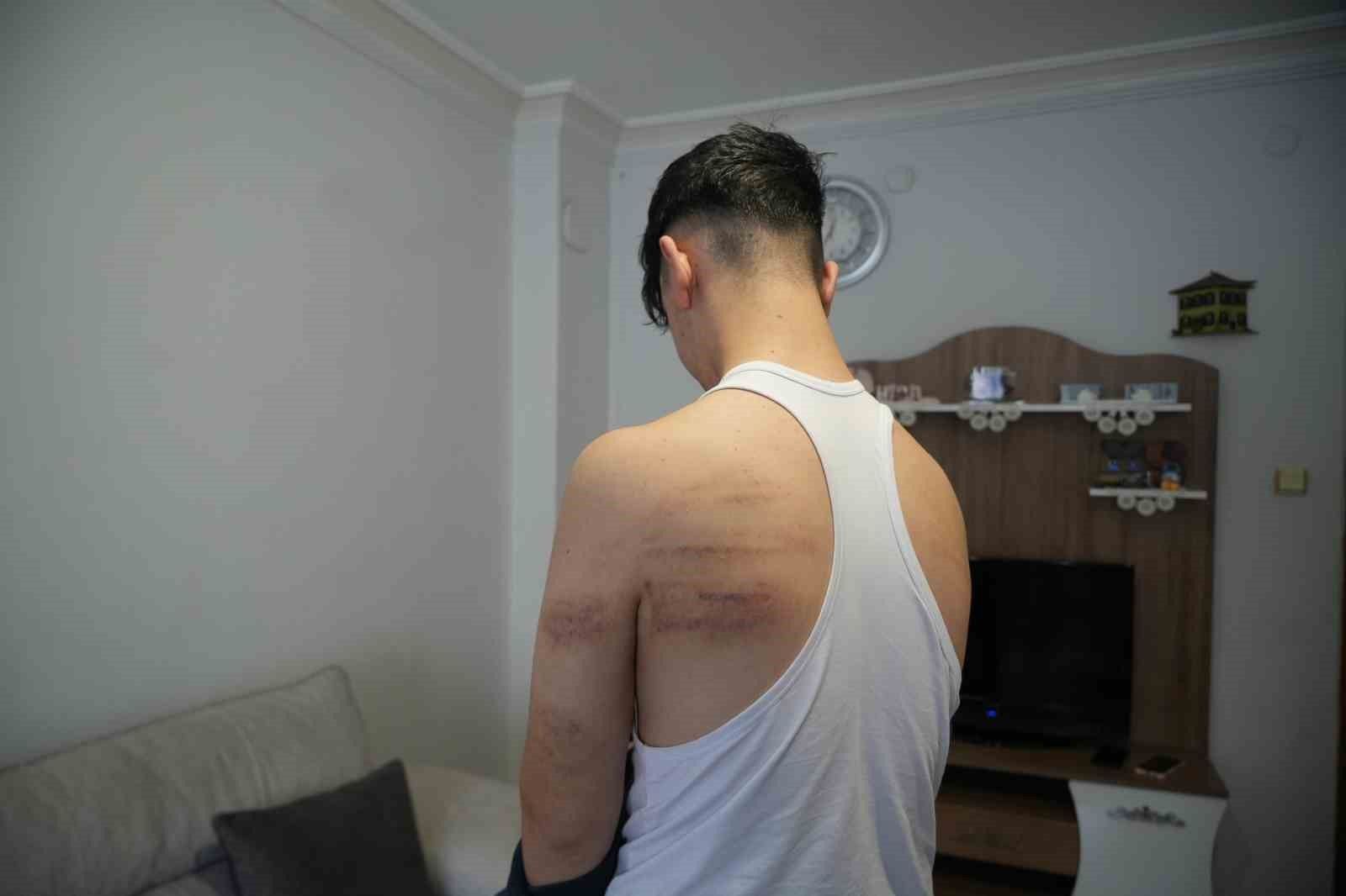 Niğde'de 15 yaşındaki berber çırağına darp iddiası: Önce dövdü, sonra temizlik yaptırdı